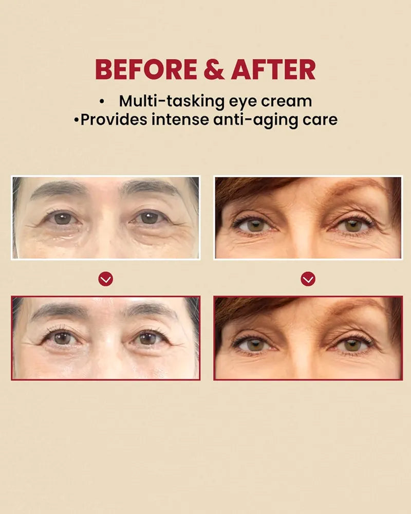 K-SECRET SEOUL 1988 Retinal Eye Cream, 30ml