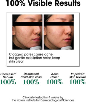 SOME BY MI AHA BHA PHA 30 Days Miracle Toner, 150ml